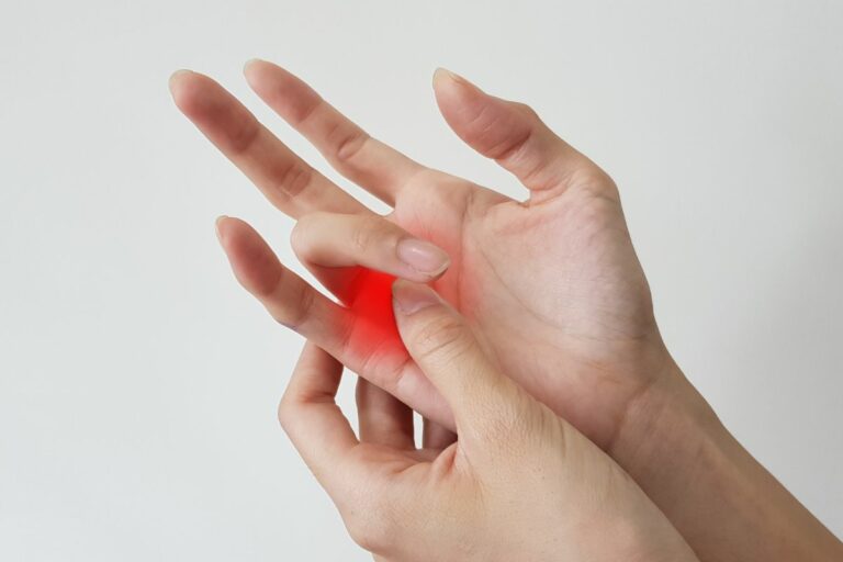 Relieve The Discomfort: Do Stress Balls Help With Trigger Finger